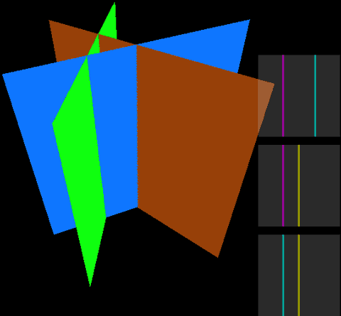 Roseman move 5